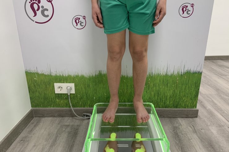 paciente sobre podoscopio