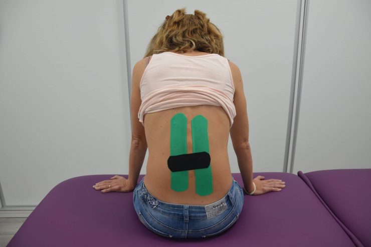 Vendaje neuromuscular
